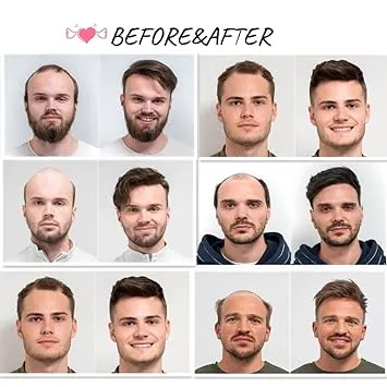 men's hair toupees in the UK